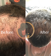 Platinum Laser-ish Growth Therapy Bundle
